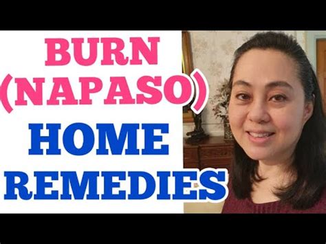 lapnos first aid|Burn (Napaso): Home Remedies .